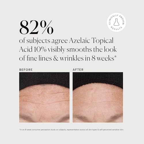 Naturium Azelaic Topical Acid 10%, Face & Skin Care Beauty Treatment with Niacinamide & Vitamin C, 1 oz
