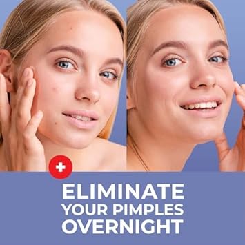 PatchRx Pimple Patches for Face (120 Patches)