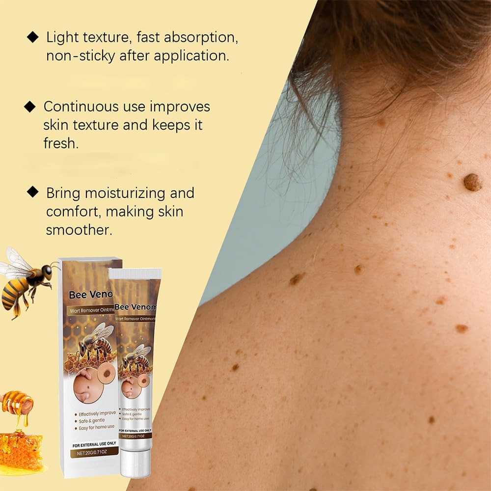 Wart Remover?Bee Venom Cream?Natural Ingredients Smooth and Moisturize The Skin Suitable for All Skin Types ( 20g )