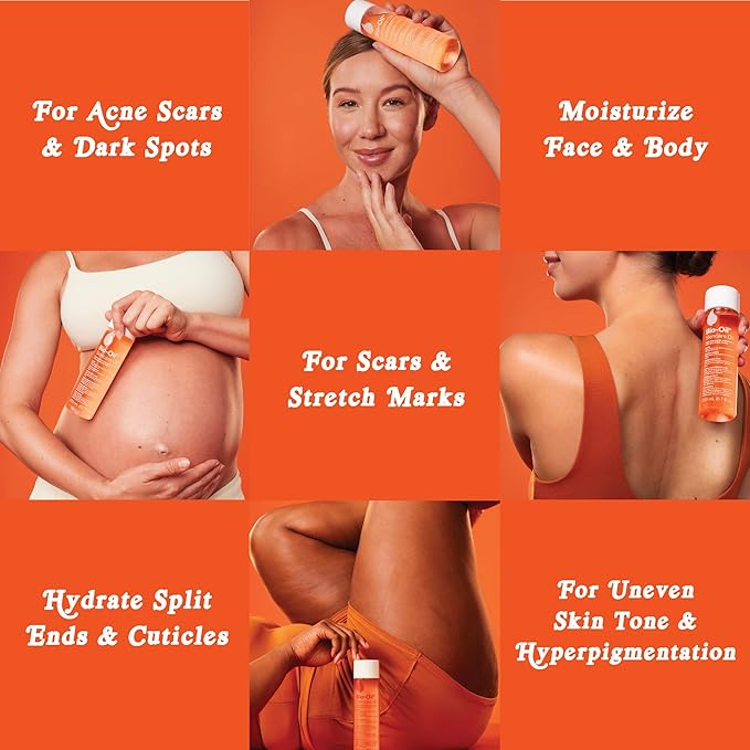 Bio-Oil Skincare Body Oil Serum, Face and Body Moisturizer with Vitamin E A, for Scars, Stretch Marks, Sensitive Skin, All Skin Types, Dermatologist Recommended, Non-Comedogenic, 2 Oz