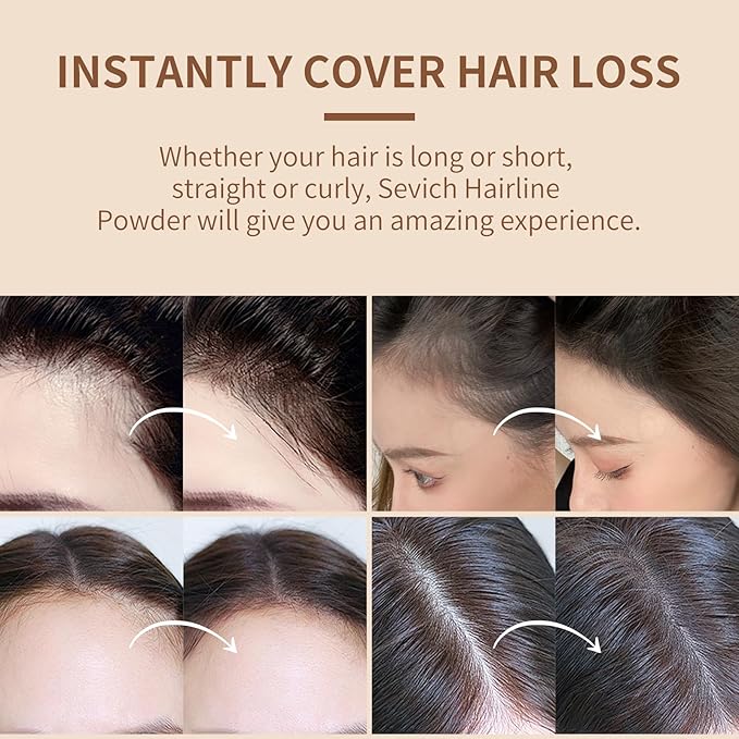 Sevich Hairline Powder, Instantly Conceals Hair Loss, Root Touch up Powder, Hair Shadow Toppers for Women & Men, Touch Up for Thinning Gray Hair, Windproof & Sweatproof(Medium Brown)