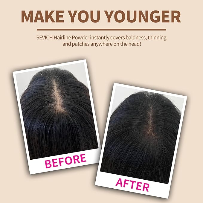 Sevich Hairline Powder, Instantly Conceals Hair Loss, Root Touch up Powder, Hair Shadow Toppers for Women & Men, Touch Up for Thinning Gray Hair, Windproof & Sweatproof(Medium Brown)