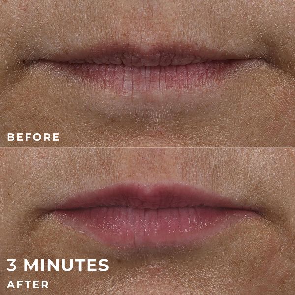 RoC Derm Correxion Lip Volumizer Treatment - 0.34 fl oz