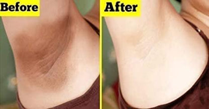 Crema Aclaradora Para Piel Manchas En Cara Axilas Cuello Entrepierna, 1 Ounce (Pack of 1)