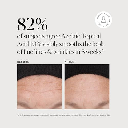Naturium Azelaic Topical Acid 10%, Face & Skin Care Beauty Treatment with Niacinamide & Vitamin C, 1 oz