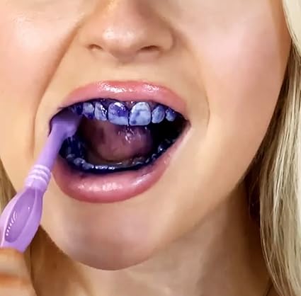 Sensitive Teeth Purple Color Corrector Toothpaste for Teeth Post Strips Removes Stains Achieving That Brighter Smile.