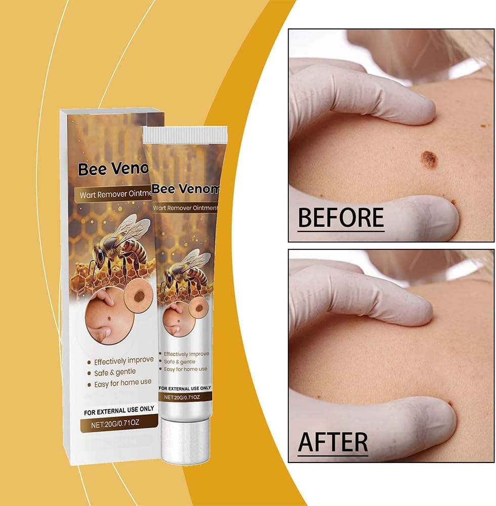 Wart Remover?Bee Venom Cream?Natural Ingredients Smooth and Moisturize The Skin Suitable for All Skin Types ( 20g )