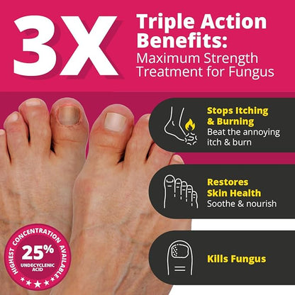 Better Nail - Treatment for Fungus Under Around the Nail - Maximum Strength, 25 Anti-Fungal Solution for Nail Support, Nail Restoring