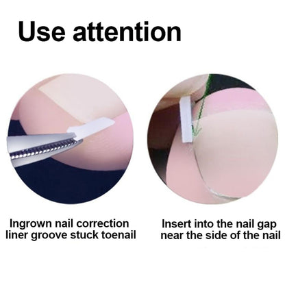 Professional Ingrown Toenail Toolkit with Breathable Ingrown Toenail Strips, Curved Toenails Corrector Patch, Painless File and Lifter for Home Pedicure Care ( box damaged)