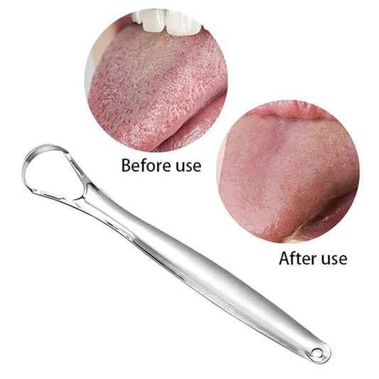 Tartar Removal Tool Oral Tongue Scraper Cleaner for Freshing Breath Portable Non-slip Handle A