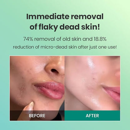 Dr.G Korean Derma Peeling Gel, 120ml - Facial Peeling Gel For Face, Exfoliating Gel For Face, Face Exfoliator, Korean Skin Care, Korean Skincare, Korean Beauty Products, Kbeauty, K Beauty Skincare