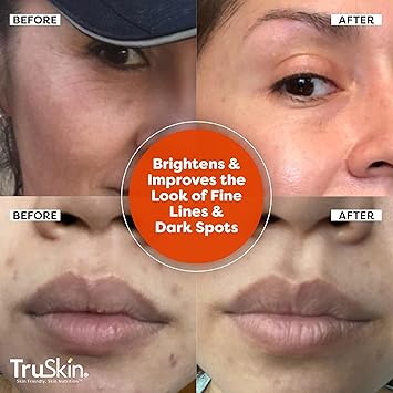 TruSkin Vitamin C Serum For Face  Anti Aging Formula with Vitamin C, Hyaluronic Acid, Vitamin E  Brightening Serum  Improve Appearance of Dark Spots, Tone, Fine Lines  Wrinkles, 1 Fl Oz