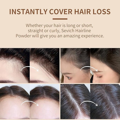Sevich Hairline Powder, Instantly Conceals Hair Loss, Root Touch up Powder, Hair Shadow Toppers for Women & Men, Touch Up for Thinning Gray Hair, Windproof & Sweatproof(Medium Brown)