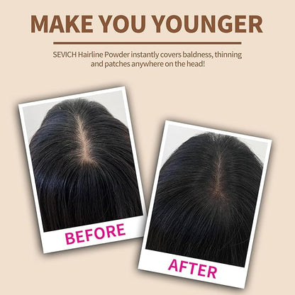 Sevich Hairline Powder, Instantly Conceals Hair Loss, Root Touch up Powder, Hair Shadow Toppers for Women & Men, Touch Up for Thinning Gray Hair, Windproof & Sweatproof(Medium Brown)