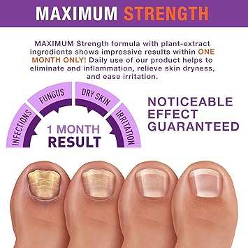 Toenail Fungus Revitalizer for Toenail  Fingernail: Advanced  Effective Formula