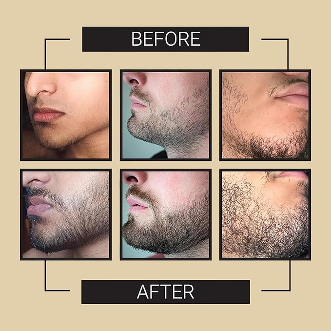 Crafted Beards Beard Growth Oil Serum - 1 fl Oz - Unscented - Helps Grow A Thicker Beard, Improves Beard Health, Fills in Thin and Patchy Spots - (1 Pack)