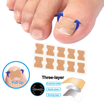 Professional Ingrown Toenail Toolkit with Breathable Ingrown Toenail Strips, Curved Toenails Corrector Patch, Painless File and Lifter for Home Pedicure Care ( box damaged)