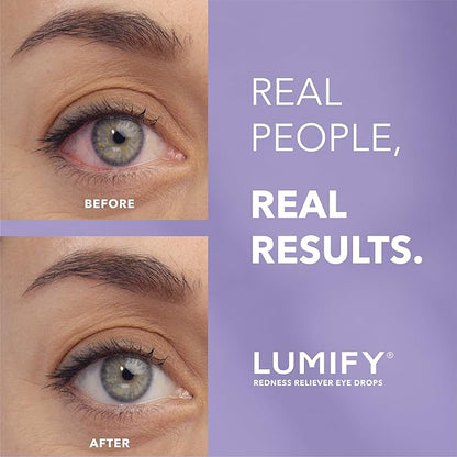 LUMIFY Redness Reliever Eye Drops, For Whiter  Brighter Looking Eyes, 0.25 Fl Oz (7.5 mL)