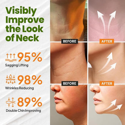 Neck Cream for Tightening Firming: Instant Face Lift Cream - Wrinkle Cream for Women- Anti Wrinkle Cream with Retinol Collagen  Hyaluronic Acid - Lifting, Firming  Hydrating - 1.7 FL OZ