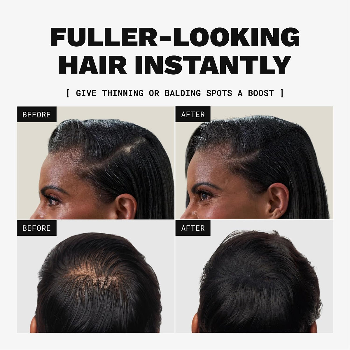 Toppik Hair Building Fibers, Fill In Fine or Thinning Hair Instantly Thicker, Fuller Looking Hair 9 Shades. ( Dark Brown/Brun/Castano Oscuro )/ ( No Original Box )