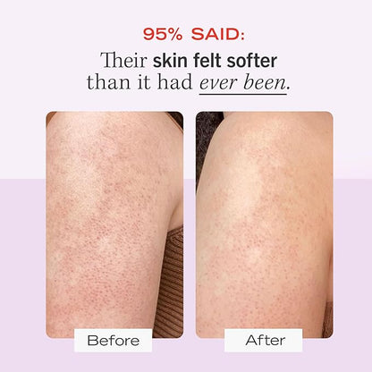 First Aid Beauty - KP Bump Eraser Body Scrub with 10 AHA, Keratosis Pilaris Skin Exfoliator with Glycolic and Lactic acids, Helps Reduce Chicken Skin Bumps, Safe for Sensitive Skin, 2 oz