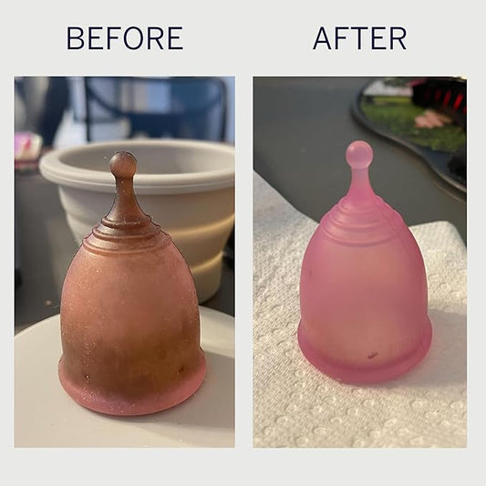 Pixie Cup Stain Remover for Wash Menstrual Cup - The Only Sterilizer Cleaner that Will Remove Stains On Your Reusable Menstrual Discs  Period Cups - Organic and Natural Ingredients (5 Packets)