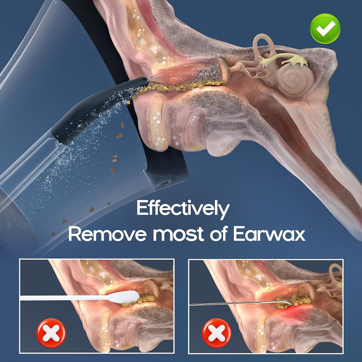 Ear Wax Removal, Electric Ear Cleaning Kit Effective & Safe Ear Cleaner Irrigation Flushing System 4 Pressure Modes for Ear Wax Buildup, Water Resistant Ear Cleaning Tool USB Rechargeable