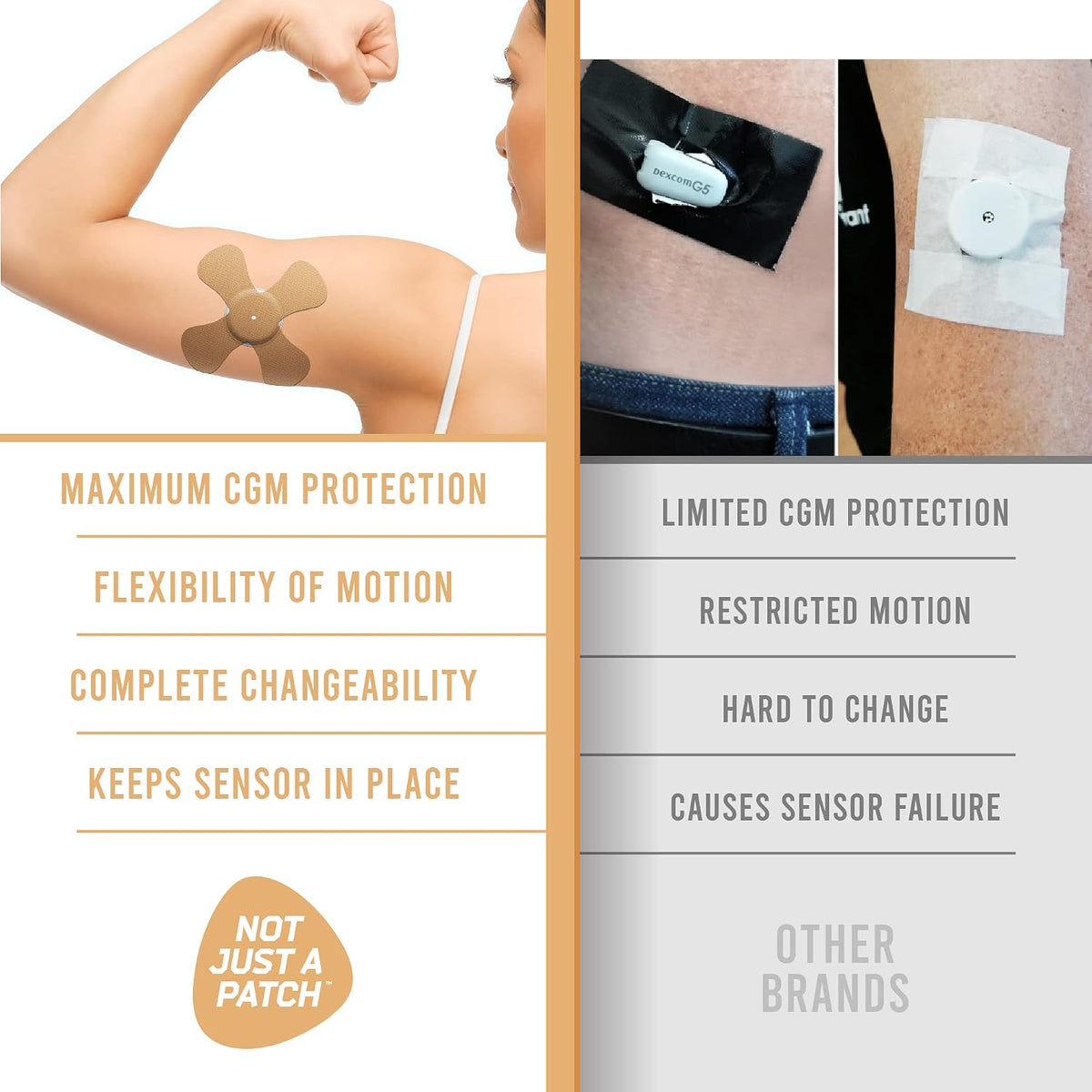 Not Just A Patch X-Patch CGM Sensor Patches (20 Pack) - Water Resistant Omnipod 5 Adhesive Patches - Durable for Active Lifestyle for 10-14 Days - Compatible with Dexcom G6, Libre 2 in Beige (Open Box) (Does not include devices)