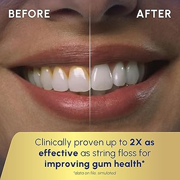 Waterpik Cordless Advanced 2.0 Water Flosser For Teeth, Gums, Braces, Dental Care With Travel Bag and 4 Tips, ADA Accepted, Rechargeable, Portable, and Waterproof, Gray WP-587, Packaging May Vary