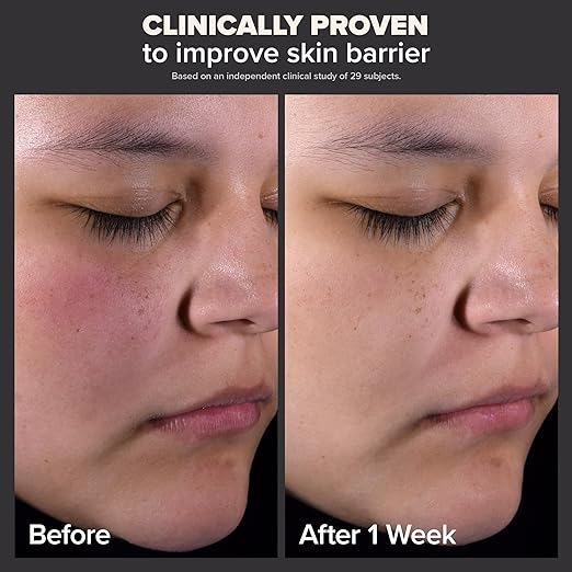 Paula's Choice SKIN PERFECTING 2 BHA Liquid Salicylic Acid Exfoliant-Facial Exfoliant for Blackheads, Enlarged Pores, Wrinkles  Fine Lines