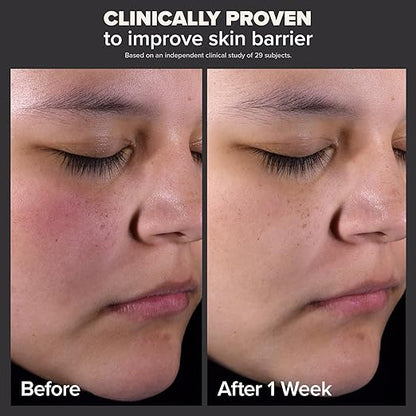 Paula's Choice SKIN PERFECTING 2 BHA Liquid Salicylic Acid Exfoliant-Facial Exfoliant for Blackheads, Enlarged Pores, Wrinkles  Fine Lines