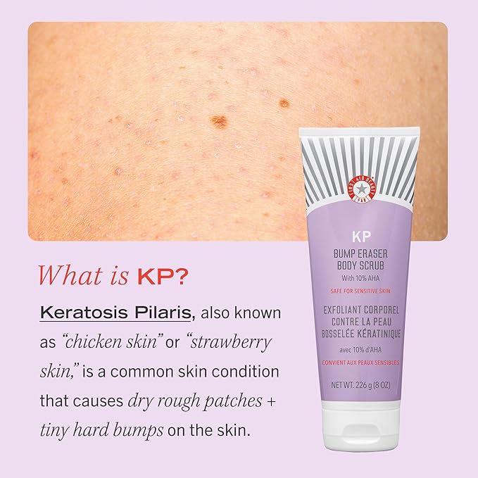 First Aid Beauty - KP Bump Eraser Body Scrub with 10 AHA, Keratosis Pilaris Skin Exfoliator with Glycolic and Lactic acids, Helps Reduce Chicken Skin Bumps, Safe for Sensitive Skin, 2 oz