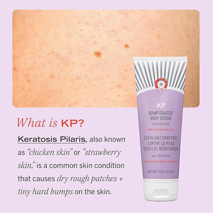 First Aid Beauty - KP Bump Eraser Body Scrub with 10 AHA, Keratosis Pilaris Skin Exfoliator with Glycolic and Lactic acids, Helps Reduce Chicken Skin Bumps, Safe for Sensitive Skin, 2 oz