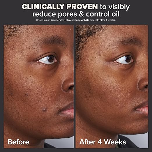Paula's Choice SKIN PERFECTING 2 BHA Liquid Salicylic Acid Exfoliant-Facial Exfoliant for Blackheads, Enlarged Pores, Wrinkles  Fine Lines