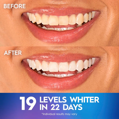 Crest 3D Whitestrips Professional Effects – Teeth Whitening Kit, 22 Treatments in 22days (20 + 2 Bonus), Each with 1 Upper/1Lower, 44 Strips – Crest 3DWhite Teeth Whitening Strips ( Little different picture, Box Damaged )