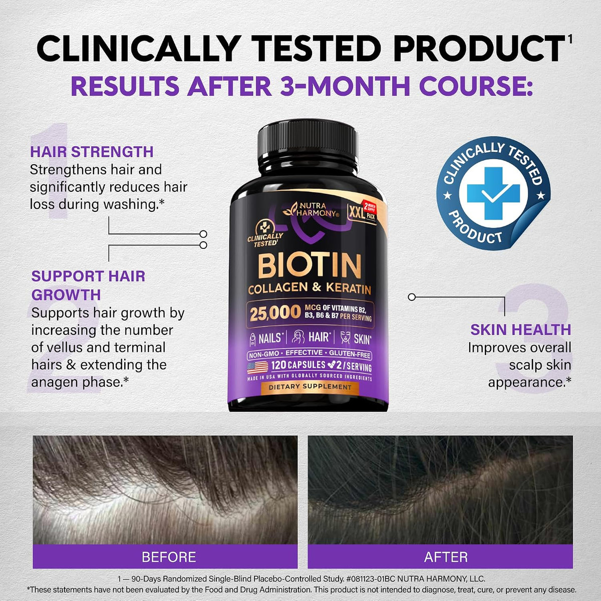 Biotin | Collagen | Hyaluronic Acid | Keratin - Support Normal Hair Growth Cycle, Skin & Nails - Clinically Tested - 25000mcg Vitamins B1, B2, B3, B6 & B7 - for Women & Men - Made in USA, 120 Capsules