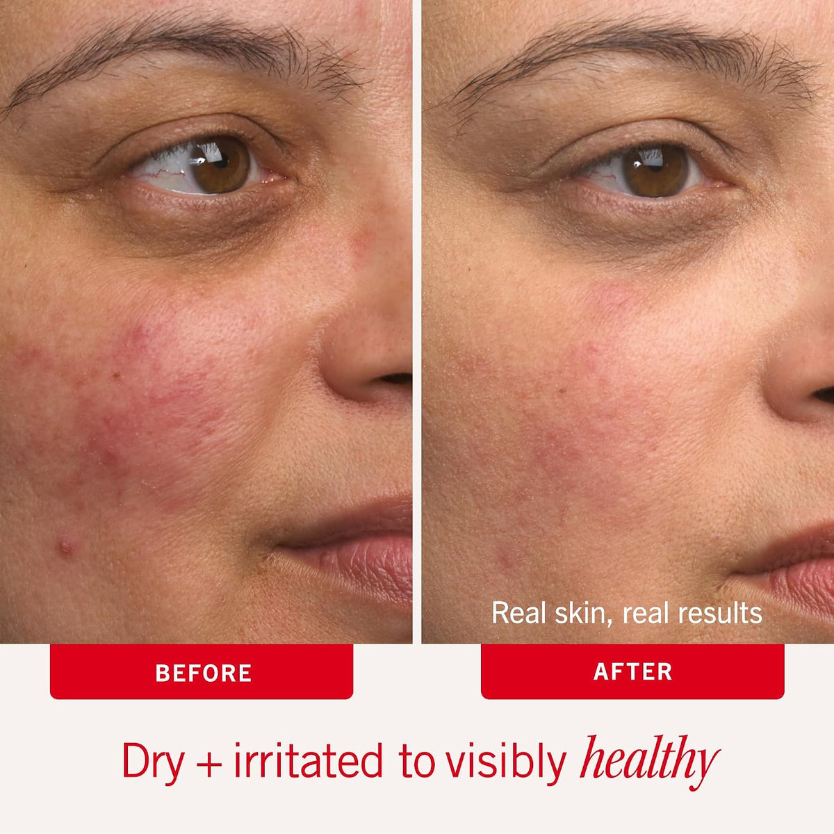 First Aid Beauty Ultra Repair Cream, Intense Hydration Face & Body Moisturizer with Colloidal Oatmeal, Helps Relieve Eczema, Dry Skin Barrier Repair, Fragrance Free