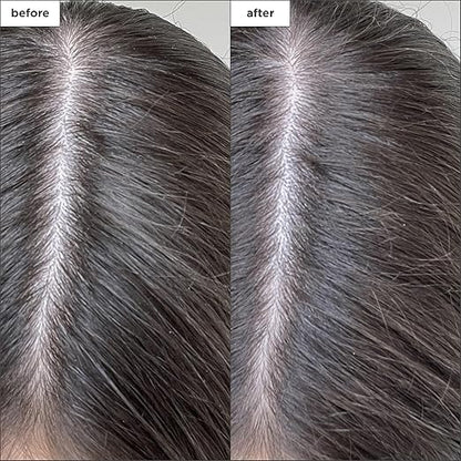 Briogeo Scalp Revival Dry Shampoo Powder, Clarifying Shampoo Scalp Cleanser for Dry Scalp  Itchy Scalp, Scalp Treatment with Tea Tree Oil for Hair, Travel Size Dry Shampoo, Detox Shampoo, 1.7 fl oz